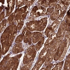Anti-TBC1D24 Antibody