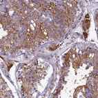 Anti-SLC26A10 Antibody