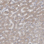 Anti-AKR1C4 Antibody