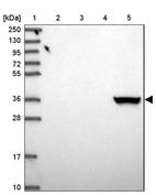 Lane 1: Marker [kDa] 250, 130, 95, 72, 55, 36, 28, 17, 10_br/_Lane 2: Human cell line RT-4_br/_Lane 3: Human cell line U-251MG sp_br/_Lane 4: Human plasma (IgG/HSA depleted)_br/_Lane 5: Human liver tissue