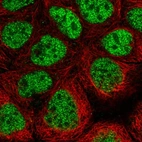 Immunofluorescent staining of human cell line CACO-2 shows localization to nucleoplasm.