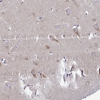 Anti-CLCN3 Antibody