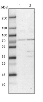 Anti-CLCN3 Antibody