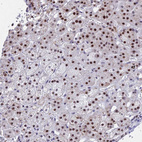 Anti-KLF14 Antibody