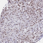 Anti-KLF14 Antibody