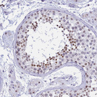 Immunohistochemical staining of human testis shows moderate nuclear positivity in spermatids.