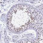 Immunohistochemical staining of human testis shows moderate nuclear positivity in spermatids.