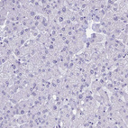 Immunohistochemical staining of human liver shows no nuclear positivity in hepatocytes as expected.