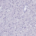 Immunohistochemical staining of human liver shows no nuclear positivity in hepatocytes as expected.