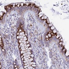 Anti-TISP43 Antibody