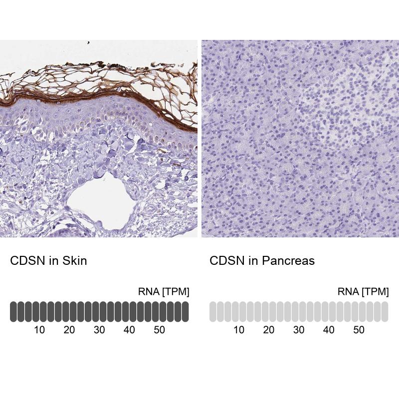 Anti-CDSN Antibody