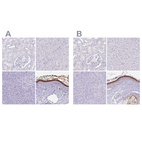 Immunohistochemical staining of human kidney, liver, pancreas and skin using Anti-CDSN antibody HPA044730 (A) shows similar protein distribution across tissues to independent antibody HPA054184 (B).