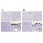 Immunohistochemical staining of human kidney, liver, pancreas and skin using Anti-CDSN antibody HPA044730 (A) shows similar protein distribution across tissues to independent antibody HPA054184 (B).