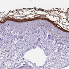 Immunohistochemical staining of human skin shows membranous positivity in stratum corneum and stratum granulosum.