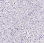 Immunohistochemical staining of human liver shows no positivity in hepatocytes as expected.