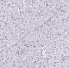 Immunohistochemical staining of human liver shows no positivity in hepatocytes as expected.