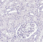 Immunohistochemical staining of human kidney shows no positivity in cells in tubules as expected.