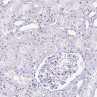 Immunohistochemical staining of human kidney shows no positivity in cells in tubules as expected.
