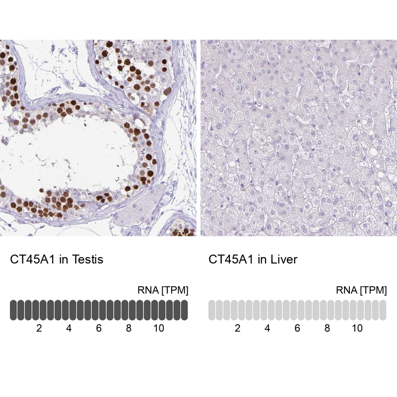 Anti-CT45A1 Antibody