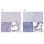Immunohistochemical staining of human cerebral cortex, liver, lymphoid tissues and testis using Anti-CT45A1 antibody HPA044735 (A) shows similar protein distribution across tissues to independent antibody HPA046872 (B).