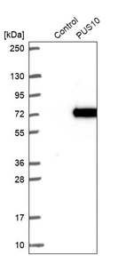 Western blot analysis in control (vector only transfected HEK293T lysate) and PUS10 over-expression lysate (Co-expressed with a C-terminal myc-DDK tag (~3.1 kDa) in mammalian HEK293T cells, LY408160).