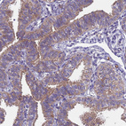 Anti-DCAF12L2 Antibody