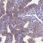 Anti-DCAF12L2 Antibody