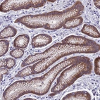 Immunohistochemical staining of human stomach shows moderate cytoplasmic and membranous positivity in glandular cells.