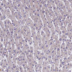 Immunohistochemical staining of human liver shows no positivity in hepatocytes as expected.