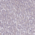 Immunohistochemical staining of human liver shows no positivity in hepatocytes as expected.