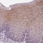 Anti-TPRG1 Antibody