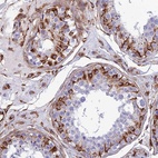 Anti-FBXL20 Antibody
