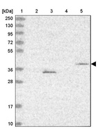 Lane 1: Marker [kDa] 250, 130, 95, 72, 55, 36, 28, 17, 10_br/_Lane 2: Human cell line RT-4_br/_Lane 3: Human cell line U-251MG sp_br/_Lane 4: Human plasma (IgG/HSA depleted)_br/_Lane 5: Human liver tissue