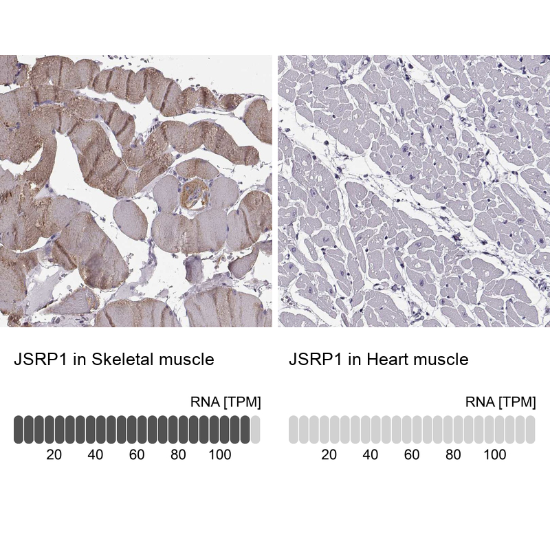 Anti-JSRP1 Antibody