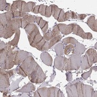 Immunohistochemical staining of human skeletal muscle shows high expression.