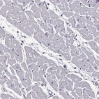 Immunohistochemical staining of human heart muscle shows low expression as expected.