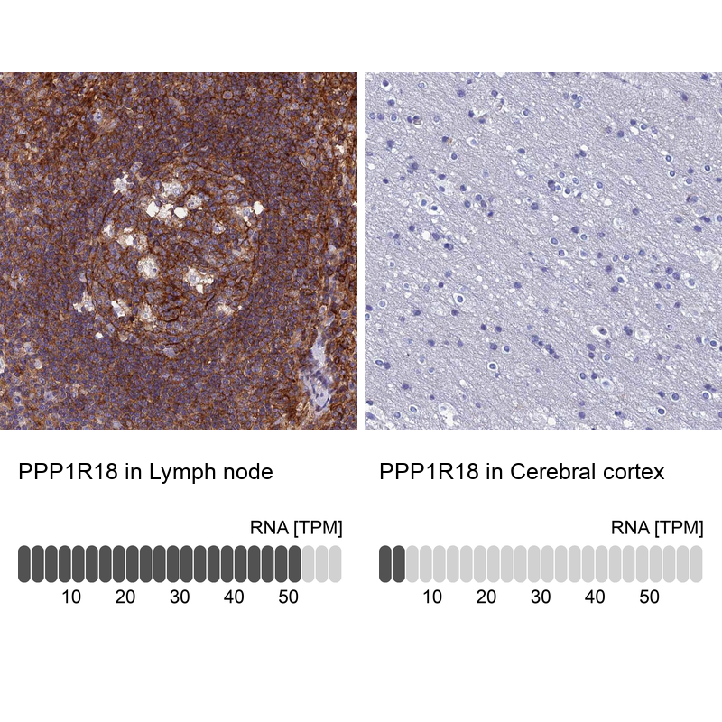 Anti-PPP1R18 Antibody