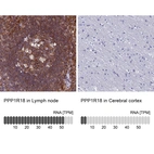 Anti-PPP1R18 Antibody