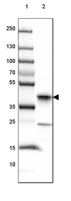 Lane 1: Marker [kDa] 250, 130, 100, 70, 55, 35, 25, 15, 10_br/_Lane 2: Human Skeletal muscle tissue