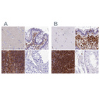 Immunohistochemical staining of human cerebral cortex, colon, lymph node and testis using Anti-PPP1R18 antibody HPA044745 (A) shows similar protein distribution across tissues to independent antibody HPA051000 (B).