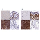 Immunohistochemical staining of human cerebral cortex, colon, lymph node and testis using Anti-PPP1R18 antibody HPA044745 (A) shows similar protein distribution across tissues to independent antibody HPA051000 (B).