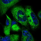 Immunofluorescent staining of human cell line RH-30 shows localization to endoplasmic reticulum.
