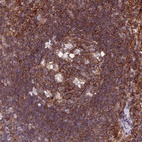 Immunohistochemical staining of human lymph node shows high expression.