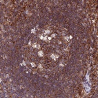 Anti-PPP1R18 Antibody