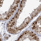 Anti-CT45A1 Antibody