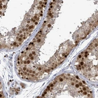 Anti-CT45A1 Antibody