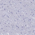 Immunohistochemical staining of human cerebral cortex shows low expression as expected.