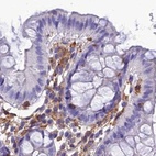 Immunohistochemical staining of human colon using Anti-PPP1R18 antibody HPA044745.