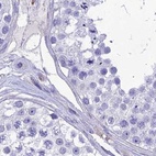 Immunohistochemical staining of human testis using Anti-PPP1R18 antibody HPA044745.