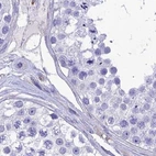 Immunohistochemical staining of human testis using Anti-PPP1R18 antibody HPA044745.